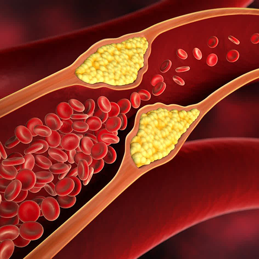Cholesterol